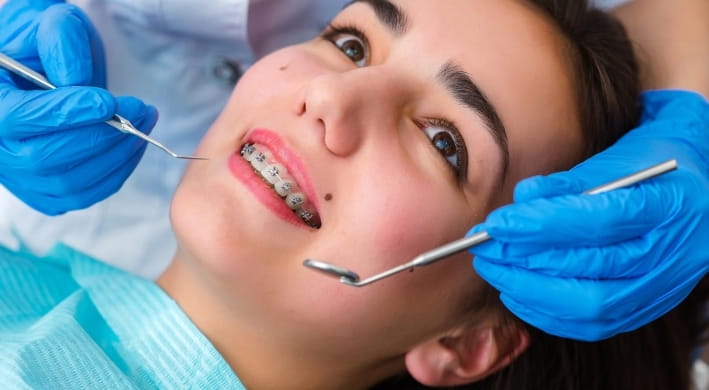 Dental Braces