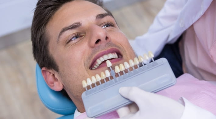 Veneers and Laminates
